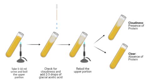 heat and acetic acid test|CHEMICAL EXAMINATION OF URINE – PROTEIN DETECTION.
